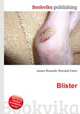 Blister, Jesse Russell,Ronald Cohn 