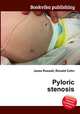Pyloric stenosis, Jesse Russell,Ronald Cohn 