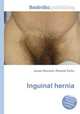 Inguinal hernia, Jesse Russell,Ronald Cohn 