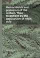 Hemorrhoids and prolapsus of the rectum. Their treatment by the application of nitric acid, Henry Smith 