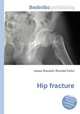 Hip fracture, Jesse Russell,Ronald Cohn 
