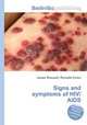 Signs and symptoms of HIV/AIDS, Jesse Russell,Ronald Cohn 