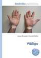 Vitiligo, Jesse Russell,Ronald Cohn 