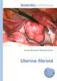 Uterine fibroid, Jesse Russell,Ronald Cohn 