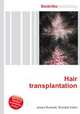 Hair transplantation, Jesse Russell,Ronald Cohn 