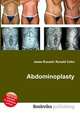 Abdominoplasty, Jesse Russell,Ronald Cohn 