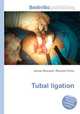 Tubal ligation, Jesse Russell,Ronald Cohn 