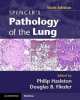 Spencer's Pathology of Lung 2-Part Set (+CD), Philip Hasleton 