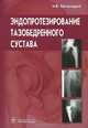 Эндопротезирование тазобедренного сустава. Основы и практика. Руководство, Загородний Николай Васильевич 