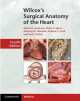Wilcox's Surgical Anatomy of Heart, Robert S. Anderson, Diane E. Spicer, Anthony M. Hlavacek, Andrew C. Cook, Carl L. Backer 