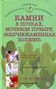 Камни в почках и мочевом пузыре, желчнокаменная болезнь, 