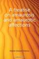 A treatise on amaurosis and amaurotic affections, Hocken Edward Octavius 