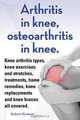 Arthritis in knee, osteoarthritis in knee. Knee arthritis types, knee exercises and stretches, treatments, home remedies, knee replacements and knee braces all covered., Robert Rymore 