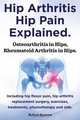 Hip arthritis, hip pain explained. Osteoarthritis in hips, rheumatoid arthritis in hips. Including hip arthritis surgery, hip flexor pain, , exercises, treatments, physiotherapy and aids., Robert Rymore 