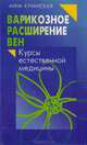 Варикозное расширение вен, Анна Кучанская 