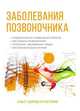 Заболевания позвоночника. Полный медицинский справочник, Ю. Ю. Елисеев 