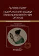 Поражения кожи при болезнях внутренних органов. Иллюстрированное руководство для врачей, Заславский Денис Владимирович, Охлопков Виталий Александрович, Сыдиков Акмал Абдикахарович 