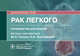 Рак легкого. Руководство. Онкология, Ганцев Шамиль Ханафиевич, Хмелевский Андрей Анатольевич 