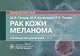 Рак кожи. Меланома. Руководство для врачей, Ганцев Ш.Х., Кзыргалин Ш.Р., Тимин К.Е. 