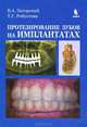 Протезирование зубов на имплантатах., Робустова Татьяна Григорьевна, Загорский Валерий Арсентьевич 