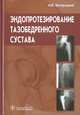 Эндопротезирование тазобедренного сустава. Основы и практика. Руководство, Загородний Николай Васильевич 
