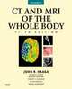 CT and MRI of the Whole Body, 2-Volume Set, 5e, Boll Daniel 