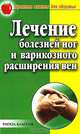 Лечение болезней ног и варикозного расширения вен - (Простые советы для здоровья), Сбитнева Е.М. 