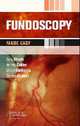 Fundoscopy made easy,, 