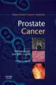 Prostate Cancer,, Arthur Skarin 