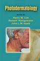 Photodermatology, Henry W. Lim 