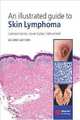 An Illustrated Guide to Skin Lymphoma. 3ed.2004, Cerroni 