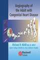 Angiography of the Adult with Congenital Heart Disease.2005, Nihill 