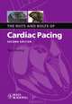The Nuts and Bolts of Cardiac Pacing, Tom Kenny 