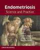 Endometriosis: Science and Practice, Linda C. Giudice 