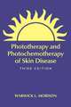 Phototherapy and Photochemotherapy for Skin Disease, Third Edition, Warwick L. Morison 