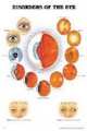 Disorders of the Eye Anatomical Chart, Anatomical Chart Company 
