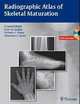 Radiographic Atlas of Skeletal Maturation, S. Lowell Kahn 