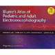 Blume's Atlas of Pediatric and Adult Electroencephalography, 
