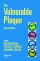 The Vulnerable Plaque, Ron Waksman 