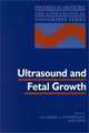 Ultrasound and Fetal Growth, Jose M. Carrera 
