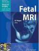 Fetal MRI, 