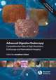 Comprehensive Atlas of High Resolution Endoscopy and Narrowband Imaging, Cohen 