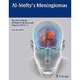 Al-Mefty's Meningiomas, Franco DeMonte 