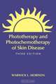 Phototherapy And Photochemotherapy for Skin Disease (Basic and Clinical Dermatology), Warwick L. Morison 