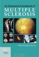 An Illustrated Pocketbook of Multiple Sclerosis, Charles M. Poser 