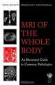 MRI of the Whole Body: An Illustrated Guide to Common Pathologies, N. Bhuskute, Edward Hoey, K. Mankad 