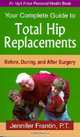 Your Complete Guide To Total Hip Replacements: Before, During, And After Surgery (An Idyll Arbor Personal Health Book), Jennifer Frantin 