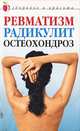 Ревматизм, радикулит, остеохондроз, Юлия Савельева 