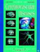 Primer on Cerebrovascular Diseases, Louis R. Caplan 