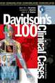 Davidson's 100 Clinical Cases 2E, 